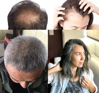 洗頭水中撒一把，頭發(fā)長(zhǎng)得又快又茂密，白發(fā)都沒(méi)了！